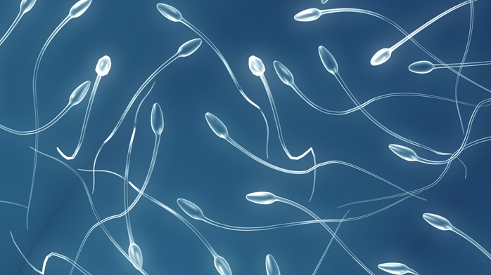 Análisis del Semen Análisis del Semen