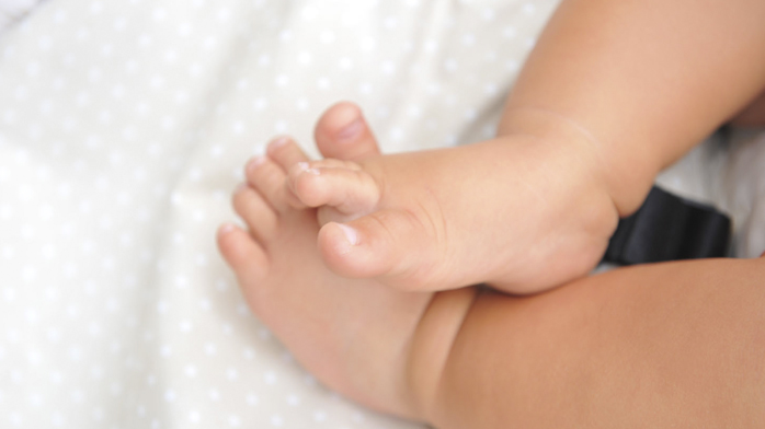 ESTUDIO DEL SÍNDROME DE X-FRAGIL EN PEDIATRÍA ESTUDIO DEL SÍNDROME DE X-FRAGIL EN PEDIATRÍA