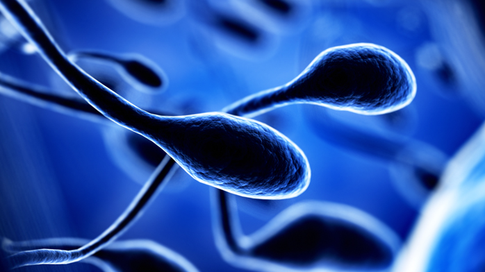 Microdeleciones cromosoma Y Microdeleciones cromosoma Y